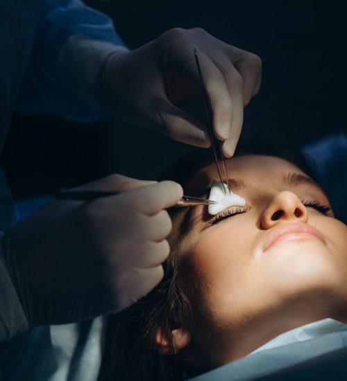 Ein Facharzt führt unter sterilen Bedingungen eine ästhetische Oberlidstraffung durch. Das Bild zeigt die Behandlung am geschlossenen Auge einer Patientin in einer modernen medizinischen Praxis bei Festhetic Medical Düsseldorf.
